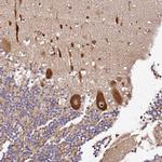 DDX27 Antibody in Immunohistochemistry (Paraffin) (IHC (P))