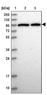 DDX27 Antibody in Western Blot (WB)