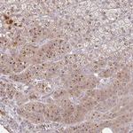 MOB1A Polyclonal Antibody