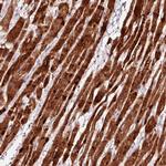 TPM3 Antibody in Immunohistochemistry (Paraffin) (IHC (P))