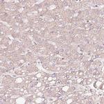 TPM3 Antibody in Immunohistochemistry (Paraffin) (IHC (P))
