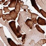 TPM3 Antibody in Immunohistochemistry (Paraffin) (IHC (P))