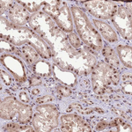 PRP6 Antibody in Immunohistochemistry (Paraffin) (IHC (P))
