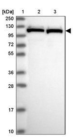 PRP6 Antibody in Western Blot (WB)
