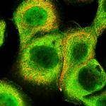 NSFL1C Polyclonal Antibody