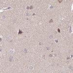 NSFL1C Antibody in Immunohistochemistry (IHC)