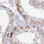 DAZ1 Polyclonal Antibody