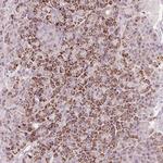 RNF39 Polyclonal Antibody