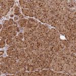 SMOX Polyclonal Antibody