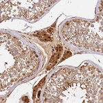 SMOX Antibody in Immunohistochemistry (Paraffin) (IHC (P))