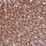 CCDC159 Polyclonal Antibody