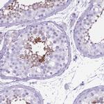 OR7C1 Polyclonal Antibody