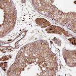 FAM186A Antibody in Immunohistochemistry (Paraffin) (IHC (P))