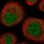 UEVLD Polyclonal Antibody