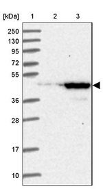 UEVLD Antibody in Western Blot (WB)