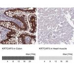 KRTCAP3 Antibody in Immunohistochemistry (IHC)