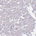 KRTCAP3 Antibody in Immunohistochemistry (IHC)