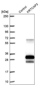 KRTCAP3 Antibody in Western Blot (WB)