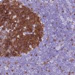 SPC25 Antibody in Immunohistochemistry (Paraffin) (IHC (P))