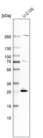 SPC25 Antibody in Western Blot (WB)