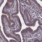 NDUFAF6 Antibody in Immunohistochemistry (Paraffin) (IHC (P))