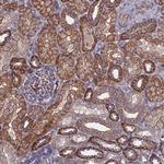 NDUFAF6 Antibody in Immunohistochemistry (Paraffin) (IHC (P))