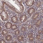 NDUFAF6 Antibody in Immunohistochemistry (Paraffin) (IHC (P))