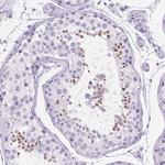 SPACA5 Polyclonal Antibody
