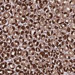 TM2D2 Antibody in Immunohistochemistry (IHC)