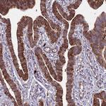 RPL36 Antibody in Immunohistochemistry (Paraffin) (IHC (P))