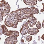 RPL36 Antibody in Immunohistochemistry (Paraffin) (IHC (P))