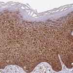 RPL36 Antibody in Immunohistochemistry (Paraffin) (IHC (P))