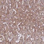 EI24 Antibody in Immunohistochemistry (Paraffin) (IHC (P))