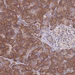 EI24 Antibody in Immunohistochemistry (Paraffin) (IHC (P))