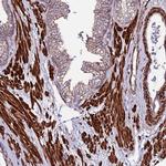 EI24 Polyclonal Antibody