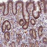 EI24 Antibody in Immunohistochemistry (Paraffin) (IHC (P))
