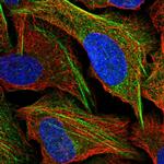 DDX59 Polyclonal Antibody