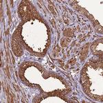 DDX59 Antibody in Immunohistochemistry (Paraffin) (IHC (P))