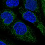 SOAT1 Polyclonal Antibody