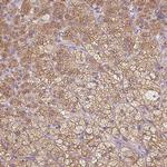 SOAT1 Antibody in Immunohistochemistry (Paraffin) (IHC (P))