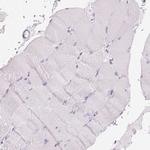 SOAT1 Antibody in Immunohistochemistry (Paraffin) (IHC (P))