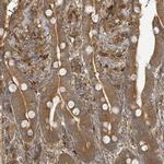 ARPIN Polyclonal Antibody