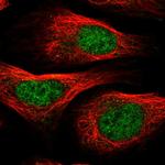 PTMA Polyclonal Antibody