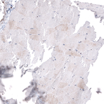 PTMA Antibody in Immunohistochemistry (Paraffin) (IHC (P))