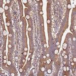 PTMA Antibody in Immunohistochemistry (IHC)