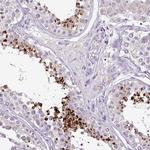DKKL1 Antibody in Immunohistochemistry (Paraffin) (IHC (P))