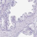 DKKL1 Antibody in Immunohistochemistry (IHC)