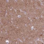 PDE10A Polyclonal Antibody