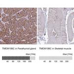 TMEM106C Polyclonal Antibody