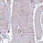 TMEM106C Antibody in Immunohistochemistry (IHC)